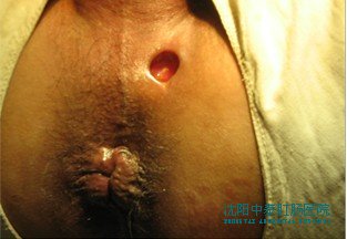 ������֮ͼ�Ľ�����ڸ���֢״